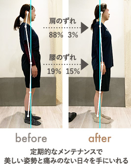 定期的なメンテナンスで美しい姿勢と痛みのない日々を手にいれる